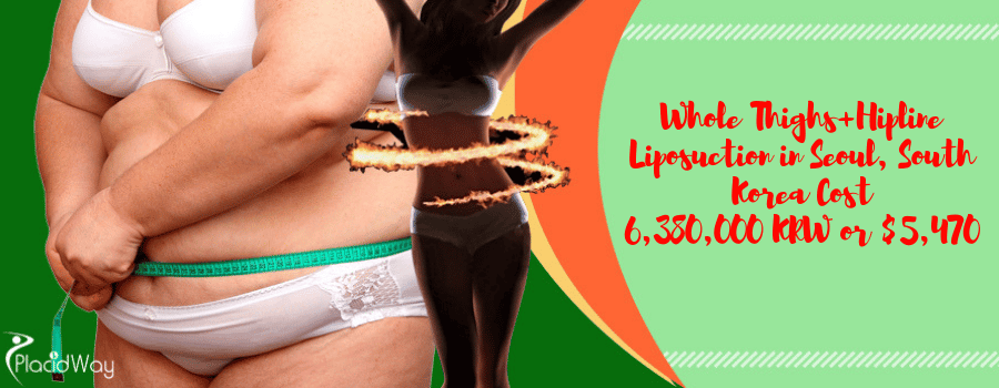 Whole Thighs+Hipline Liposuction in Seoul, South Korea Cost